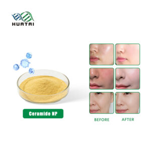 세라마이드 NP