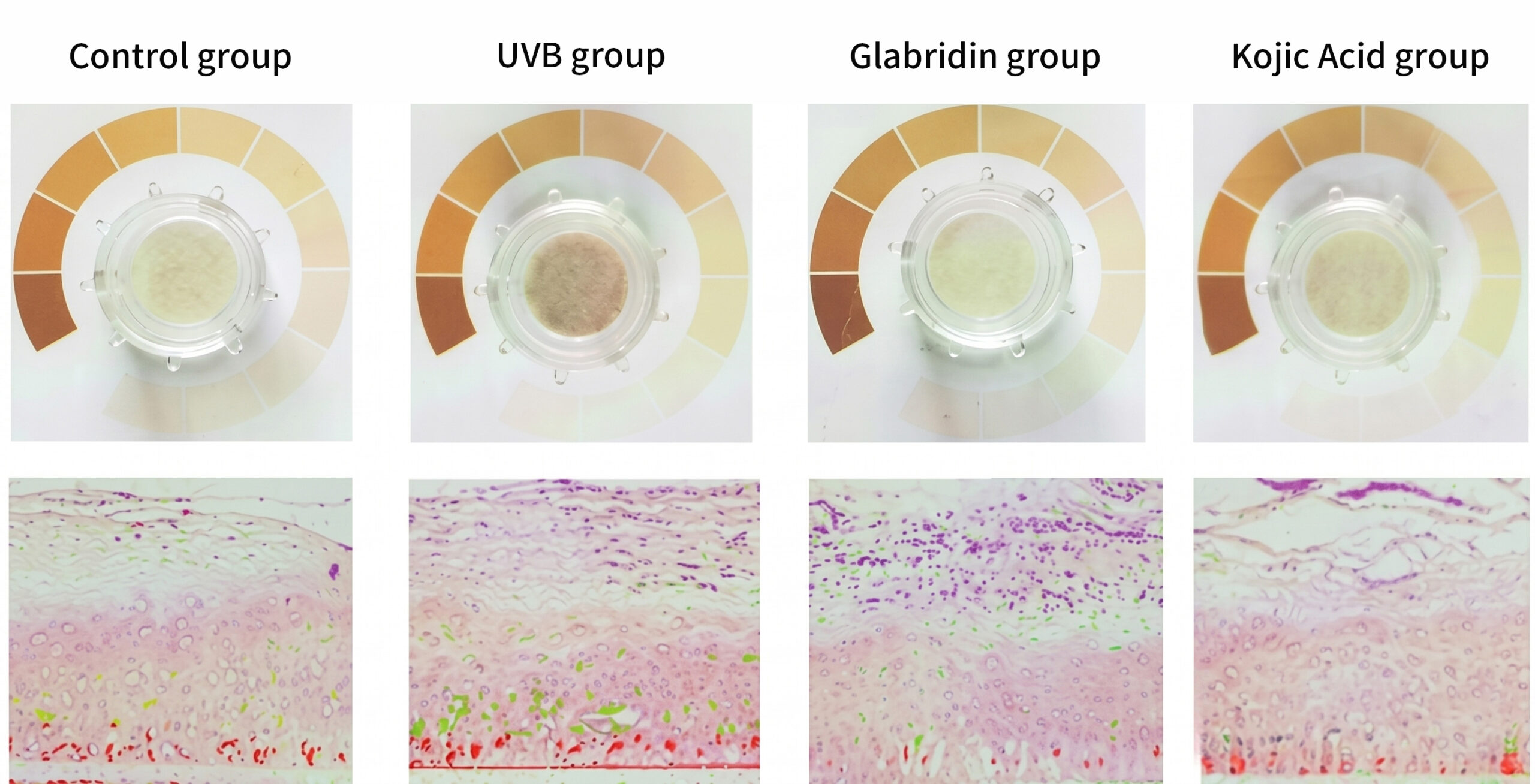 3D reconstructed skin model comparison: top row shows surface melanin color across four groups (Control, UVB, Glabridin, Kojic Acid); bottom row shows histological cross-sections with melanin staining (purple deposits)